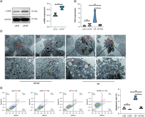 Figure 1. Activation and apoptosis of hepatic stellate cells. (A) Expression of α-SMA protein in LX-2 and LX-2T (TGF-β) cells detected by western blotting. (B) The mRNA expression of TET3 in LX-2 and LX-2T. TET3 upregulation and TET3 upregulation NC groups was detected by RT-qPCR. (C) Transmission electron microscopy was used to observe cell tissue damage and apoptosis in TET3 upregulation and TET3 upregulation NC groups. Red arrow: endoplasmic reticulum; blue arrow: mitochondrial ridge; yellow arrow: perinuclear space. (D) Flow cytometry was used to detect cell apoptosis in each group.*p < 0.05; **p < 0.01.NC: Negative control.