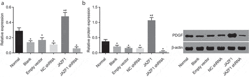 Figure 9. Over-expressed JAZF1 increases the expression of PDGF while silencing brings about the opposite results. (a), relative mRNA level of PDGF in CMECs after transfection using RT-qPCR; (b), relative protein level of PDGF in CMECs after transfection detected by western blot analysis; *, p < 0.05 vs. the normal group; #, p < 0.05 vs. the blank, empty vector and NC shRNA group; NC, negative control; shRNA, short hairpin RNA; CMECs, cardiac microvascular endothelial cells; JAZF1, the juxtaposed with another zinc finger protein 1; PDGF, platelet-derived growth factor.