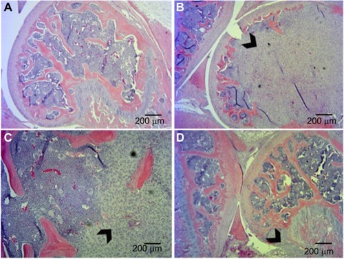 Figure 4 Histological analysis of tumor xenografts in bone represented by hematoxylin and eosin staining.
