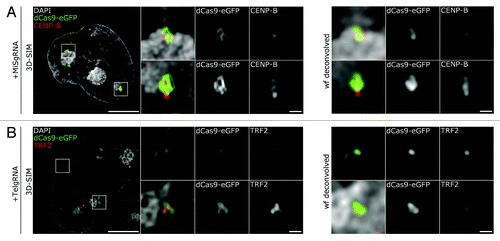 Figure 4. 3D-SIM highlights the ultrastructure of MiS and Tel repeats. (A) Left panel depicts a mid z-section of a DAPI stained nucleus (gray) in MiSgRNA/dCas9-eGFP (green) expressing cells immunolabeled with anti-CENP-B antibodies (red). Four × magnifications of boxed areas (mid gallery) show the spatial association of dCas9-eGFP decorated domains to CENP-B assemblies. Wide-field (wf) deconvolved simulations of the corresponding 3D-SIM magnifications are shown for comparison (far right gallery). Bar, 5 µm; magnifications, 500 nm. (B) Left panel depicts a mid z-section of a DAPI stained nucleus (gray) in TelgRNA/dCas9-eGFP (green) expressing cells immunolabeled with anti-TRF2 antibodies (red). Four × magnifications of boxed areas (mid gallery) show overlapping pattern of dCas9-eGFP signals with TRF2. Wide-field (wf) deconvolved simulations of the corresponding 3D-SIM magnifications are shown for comparison (far right gallery). Note the elucidation of interconnected ovoid intensities within the telomere-cluster (mid-gallery, lower panel, and dCas9-eGFP). Bar, 5 µm; magnifications, 500 nm.