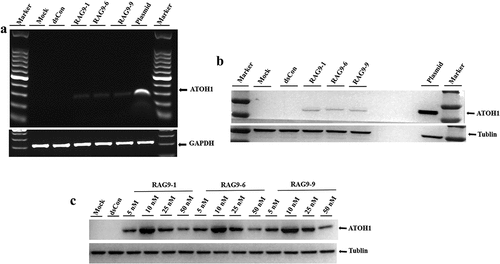 Figure 4. Validation of selected small activating RNAs (RAG9-1, RAG9-6 and RAG9-9) in hair cell progenitor cells. The 3 selected small activating RNAs, the plasmids containing the ATOH1 gene and the dsRNA were transfected into hair cell progenitor cells to verify the activation effect of small activating RNAs in hair cell progenitor cells. Then, a dose–response transfection was performed to determine the most potent concentration. As shown in A and B, expression of the ATOH1 gene was detected in the small activating RNA treatment group and the plasmid treatment group but not in the blank control group and the dsCon group. The results indicate that RAG9-1, RAG9-6 and RAG9-9 were able to activate the expression of the ATOH1 gene in progenitor cells. As shown in C, the expression of the ATOH1 gene was highest when the concentration of the 3 small activating RNAs was 10 nM. This result indicates that the most effective activation concentration for the small activating RNAs was 10 nM in hair cell progenitor cells.
