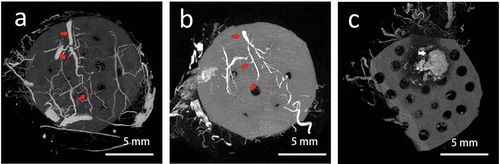 Figure 5. The reconstruction of vessel structure by micro CT scan. (a) the whole tissue was well-vascularized. The vessel pedicle within the chamber could be seen clearly as the right arrow showed. (b) There was also a clear pedicle vessel with several branches, but less branches could be observed than that of in group A. (c) there was no obvious vascular structure within or around the grafted fat, massive calcification could be seen as the necrotic sign
