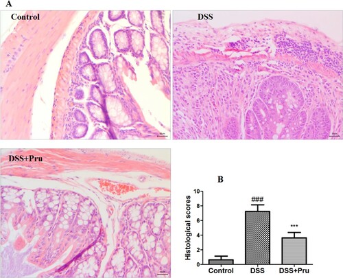 Figure 6. Pru ameliorated DSS-induced colon injury in rats. (A) Representative H&E-stained images in different groups (original magnification × 200). (B) Histological scores in different groups. Experimental data were presented as mean ± SD. Significance: ###P < 0.001 in comparison with the control group; ***P < 0.001 in comparison with the DSS group.