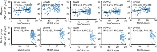 Figure 5 Correlation between CBF and MoCA score in the AD and control group. In the AD group, the CBF of the whole brain, DWM, PVWM and JVWM showed a positive relationship with the MoCA score (r=0.184, 0.141 and 0.155, P<0.05) while the CBF of JCWM had no relationship with MoCA score. There was no close correlation between CBF at different regions and MoCA score in the control group.