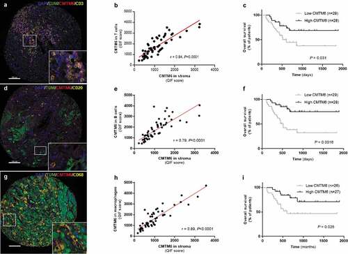 Figure 2. CMTM6 in the immune populations from immunotherapy-treated patients with melanoma. Representative images showing expression of CMTM6 in T cells (a), B cells (d), and macrophages (g) by colocalization of CMTM6 and CD3, CD20, and CD68 markers, respectively. Correlation between CMTM6 QIF scores in the stromal compartment versus CMTM6 expression in T cells (b), in B cells (e), and in macrophages (h). Overall survival based on CMTM6 expression in T cells (c), in B cells (f), and in macrophages (i) in patients treated with immunotherapy. r = Pearson’s correlation coefficient; DAPI, 4ʹ6-diamino-2-phenylindole; TUM (tumor cells = HMB45+ and S100+) (scale bar = 100 µm)