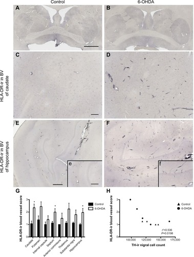Figure 4 Increased expression of HLA-DR in blood vessels of 6-OHDA-treated monkeys. Microphotographs of HLA-DR immunostained striatum at the level of the anterior commissure of a control monkey (A) and a 6-OHDA-treated monkey (B). Mild HLA-DR expression was found in the cerebrovasculature of a control animal in the caudate (C) and hippocampus (E, e), while HLA-DR-ir was upregulated in 6-OHDA animals in the caudate (D) and hippocampus (F, f). HLA-DR-ir blood vessel scores were significantly higher in the caudate, septum, and hippocampus of 6-OHDA-treated animals compared with controls (G). Scores for HLA-DR-ir blood vessels negatively correlated with TH-ir nigral cell counts (H). *P<0.05. Scale bar: (A and B) =10 mm, (C–F) =500 μm; insets =100 μm.Abbreviations: 6-OHDA, 6-hydroxydopamine; BV, blood vessel; HLA, human leukocyte antigen; TH, tyrosine hydroxylase; ir, immunoreactivity.