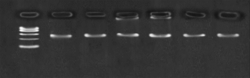 Figure 1. Detection of SNP PCR product in agarose gel electrophoresis