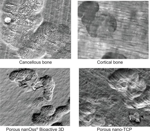 Figure 9 Representative SEM images of osteoclast resorption pits on the various substrates after 21 days of culture.Note: Magnifications =10,000×.Abbreviations: SEM, scanning electron microscopy; HA, hydroxyapatite; TCP, tri-calcium phosphates.