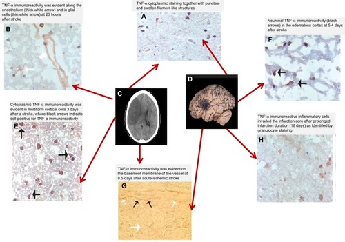 Figure 3 TNF-α brain tissue distribution and its temporal kinetics after an ischemic stroke (A–H).