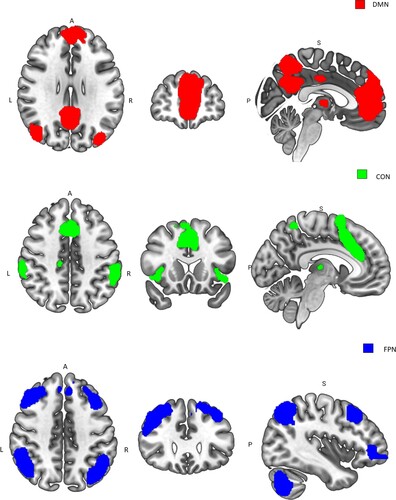 Figure 1. A neurofunctional account of ACT emphasises the differential involvement of three brain networks (DMN; CON; FPN)* during task performance by individuals with high and low trait anxiety or worry. Neural activity in the FPN is anti-correlated with activity in the DMN, where the activity in the FPN increases due to attentional demands, activity in the DMN decreases (or deactivates) over the duration of a task requiring some attentional control. During high load, where compensatory processes are required, activity in CON regions increases to maintain effective task performance by signalling the need for increased attentional control. CON activity is required to compensate for altered FPN activity. Note the temporal relationship between FPN and CON activity/connectivity is not well understood in this context alternative temporal relationship are possible. *ROIs are from Shirer et al. (Citation2012).