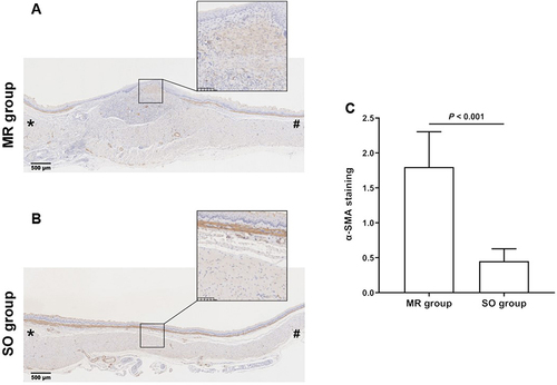 Figure 5 Longitudinal immunohistochemistry staining (α-SMA) of rat esophagus 2 weeks after the operation. (A) In the mucosal resection group, a large number of α-SMA positive myofibroblasts (arrows) was found in the submucosal layer. (B) In the sham-operated group, almost no α-SMA positive myofibroblasts were found in the submucosal layer. (C) The mean degree of α-SMA positive deposition per unit area was higher in the mucosal resection group than that in the sham-operated group (1.8 ± 0.5 vs 0.5 ± 0.2, P < 0.001). Data are presented as mean ± standard deviation. *caudal side; #Cranial side.