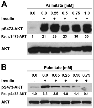 Figure 4. Palmitate does not inhibit insulin signaling in 3T3-F442A adipocytes. (A) Serum-starved 3T3-F442A adipocytes and (B) serum-starved undifferentiated 3T3-F442A cells were treated with the indicated concentrations of BSA-complexed palmitic acid for 48 h before stimulation with 100 nM insulin for 15 min. Phosphorylation of AKT at serine 473 and total AKT levels were determined by Western blotting.