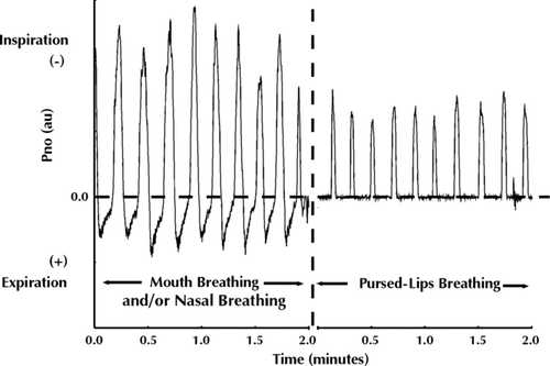 Figure 1.  Example of a nasal pressure (Pno) recording obtained in a representative subject. Expiration performed through either the nose or the mouth produces a positive deflection of Pno (left half), whereas PLB causes Pno to drop to 0 cm H2O during the expiratory phase of breathing (right half).