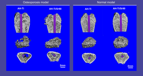 Figure 8 Micro-CT images of reconstructed 3D models of surrounding bones with implants.