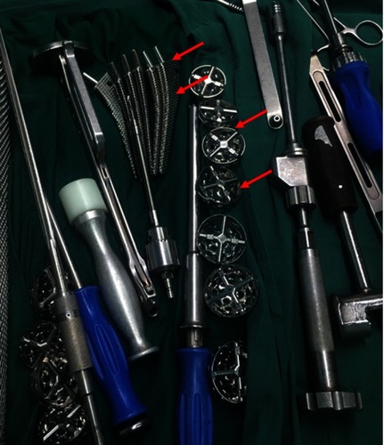 Figure S1 During the procedures of actual surgery, hospitals always need to prepare several spare prostheses for doctors to choose. The red arrow referred to the hip joint prostheses.