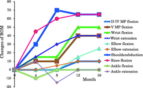 Fig. 1 Impact of tocilizumab (TCZ) on joint mobility in a patient with SSc. Joint range of motion (ROM) was initially set to zero, and data are expressed as the degree of improvement during the 16-month TCZ therapy. The horizontal axis indicates months after TCZ initiation. All ROM values, except for those in the ankles, improved considerably after 4 months and continued to improve until the end of study. The unit of angle is degrees