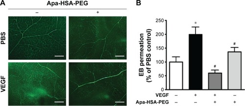 Figure 4 Apa-HSA-PEG nanoparticles block VEGF-induced retinal vascular leakage in vivo.Notes: (A) Representative images of FITC-dextran-perfused retinal whole mounts. (B) Quantitative analysis of extravasated EB dye in the retinal tissues after intravitreal injection of rhVEGF (100 ng) and/or Apa-HSA-PEG nanoparticles (580 ng). Vascular leakage of EB dye in treated eyes was normalized relative to that in each contralateral control eye (means ± SEM, *P<0.05 vs PBS control, #P<0.05 vs VEGF, n=5). Scale bar =200 µm.Abbreviations: Apa-HSA-PEG, apatinib-loaded human serum albumin-conjugated polyethylene glycol; VEGF, vascular endothelial growth factor; FITC, fluorescein isothiocyanate; EB, Evans Blue; rhVEGF, recombinant human VEGF; SEM, standard error of the mean; PBS, phosphate-buffered saline.