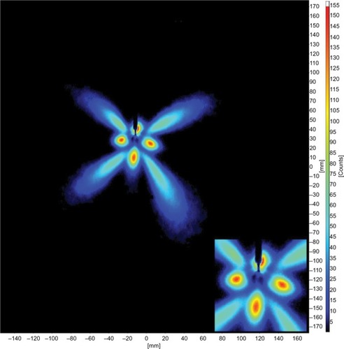 Figure 10 Radial catheter laser sheet imaging showing droplet counts as a function of position (inset image in lower right corner shows enlarged center pattern image. Inset scale not shown).
