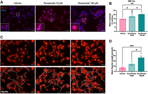 Figure 5 Roxadustat dose dependently increased the nuclear translocation of HIF-1α and TH-positive sympathetic neurite length of nerve growth factor-differentiated PC12 cells.