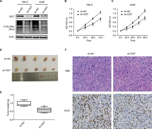 Figure 2 OGT suppression inhibits RCC growth in vitro and in vivo.Notes: (A) Expression levels of OGT and O-GlcNAcylation after OGT knockdown in 786-O and A498 cells. (B, C) CCK8 assay was used to assess the proliferation of 786-O and A498 cells after OGT knockdown. (D) Representative images and animal weights. (E) Weights of the excised tumors derived from nude mice are shown. (F) Representative images of H&E staining and Ki-67 immunohistochemical detection in the excised tumors derived from nude mice. Data are mean ± SD from three independent experiments. *P<0.05. Magnification ×200.Abbreviations: CCK8, Cell Counting Kit-8; O-GlcNAc, O-linked N-acetylglucosamine; OGT, O-GlcNAc-transferase; NC, negative control; RCC, renal cell carcinoma.