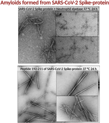 Figure 3. TEM micrographs of (on top) full length Spike-protein (Wuhan strain) after co-incubation with neutrophil elastase at 37°C for 24 h. The in silico predicted peptide 192–211 of SARS-CoV-2 Spike-protein, incubated at 37°C for 24 h. The resulting fibrils are straight, twisted and rod-like [Citation81].
