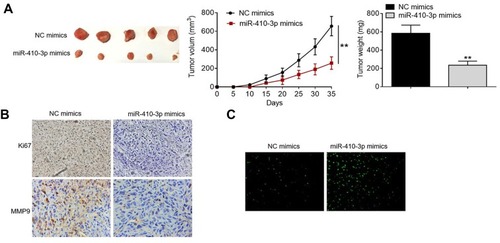 Figure 6 MiR-410-3p over-expression tumor growth in mouse xenograft models. (A) Lentivirus-mediated stably transfected U251MG cells were established and used for tumor transplantation models. miR-410-3p mimics-treated U251MG cells were subcutaneously injected into the flanks of the nude mice (n=5). Tumor volumes were measured every 5 days; at day 35 post-implantation, all the mice were sacrificed under anesthesia and tumors were weighed. (B) Ki67 and MMP9 protein expression in the collected tumors was visualized by IHC staining. (C) Cell apoptosis in the collected tumors was detected by TUNEL analysis. **P<0.01.Abbreviations: IHC, immunohistochemistry; MMP, matrix metalloproteinase 9; NC, negative control; TUNEL, terminal deoxynucleotidyl transferase-mediated nick end labeling.