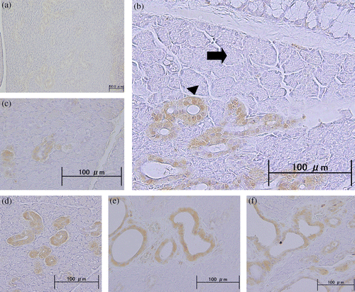 Figure 5  BDNF immunohistochemistry in submandibular gland. Photomicrographs show the immunohistochemical localization of BDNF protein, identified with an anti-BDNF monoclonal antibody in paraffin-embedded sections of submandibular gland from: (a) a non-stressed rat: only faint staining was observed; (b)–(f) rats after daily 12 h restraint stress for 22 days: BDNF protein was observed in duct cells, and there was no obvious BDNF expression in acinar cells (arrow) or myoepithelial cells (arrowhead; b). BDNF protein was immunolocalized in the intercalated (c), striated (d), interlobular, intralobular (e), and excretory ducts (f). Scale bars = (a) 500 μm; (b)–(f) 100 μm.