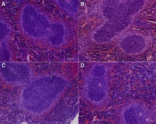 Figure 5 Hematoxylin and eosin-stained images of the kidney from control (A) and mice injected ZrO2 at the dose 100 mg/kg (B), 350 mg/kg (C) and 500 mg/kg (D). (Bar is 100 μm).