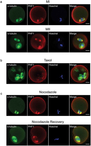 Figure 2. Localization of PHF1 in mouse oocytes treated with taxol and nocodazole. (a) Oocytes cultured for 7 h and 13 h, corresponding to MI and MII stages, respectively. These oocytes were fixed and co-stained with PHF1 (red) and α-tubulin (green). DNA (blue) was visualized with Hoechst 33342 staining. Scale bar = 20 μm. (b) Oocytes at MI stage were incubated in M2 medium with 10 μM taxol for 45 min and then double stained with PHF (red) and α-tubulin (green). The sample was counterstained with Hoechst 33342 to visualize DNA. Scale bar = 20 μm. (c) The MI oocyte first treated with M2 medium containing 10 mg/ml nocodazole, and then washed thoroughly with fresh M2 medium. After recovering for 30 min the oocytes were fixed and stained for PHF1 (red), α-tubulin (green) and DNA (blue). Scale bar = 20 μm.