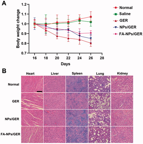 Figure 6. In vivo toxicity of nanoparticles in AIA rats. (A) Body weight variations after treatment over time. (B) H&E staining and histological analysis images were obtained in major organs and tissues. Those are representative sections from five rats analyzed for each group. Scale bar = 100 μm.