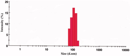 Figure 11. Size distribution by the intensity of TR-OP-SLN3 by DLS.