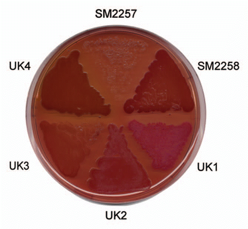 Figure 4 Colony morphotypes of bacterial strains when grown on Congo red agar plates. Bacteria were grown for 48 h at 26°C. It was subsequently possible to purify and identify amyloid from the strain designated UK4.
