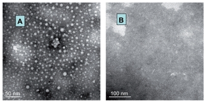 Figure 4 Transmission electron microscope images for (A) small interfering RNA/polyethylenimine-polyethylene glycol complexes and (B) naked small interfering RNA solution in phosphate-buffered saline (7.4).
