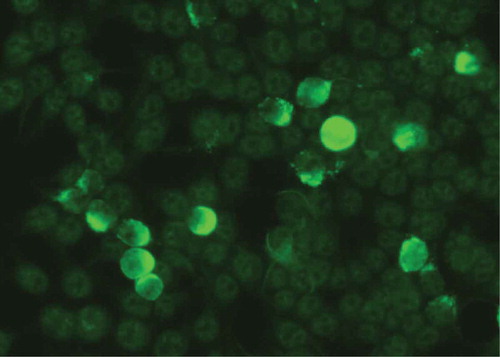 Figure 11. Indirect immunofluorescence on HEK 293 cells expressing the recombinant NC1 domain of type VII collagen on their cell surface.