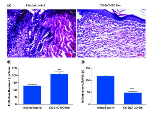 Figure 6.  Histopathological examinations.(A) Representative H&E stained tissue slices from different groups on day 15. Wound healing statistical data of different groups after 15 days of treatment. (B) Epithelium thickness (μm/1 mm). (C) Number of inflammation cells/field.****p < 0.0001; ***p < 0.001.CS–ZnO–GO:Chitosan–zinc oxide–graphene oxide.