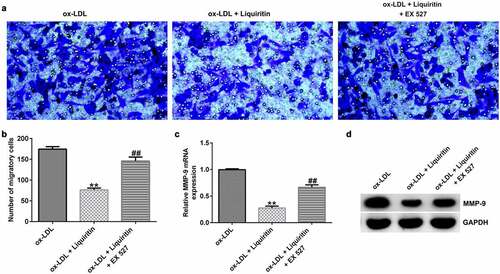 Figure 7. EX 527 reverses the effects of liquiritin on cell migration in ox-LDL-induced hVSMCs. hVSMCs were treated with 80 μM liquiritin or/and 10 μM EX 527 in the presence of 100 μg/mL ox-LDL for 24 h. (a, b) The migration ability of the treated hVSMCs was evaluated by Transwell assay. (c, d) MMP9 mRNA and protein expression in the treated ox-LDL-induced hVSMCs was measured by RT-qPCR and Western blot analysis. **P < 0.01 vs. ox-LDL; ## P < 0.05, 0.01 vs. ox-LDL+liquiritin group.