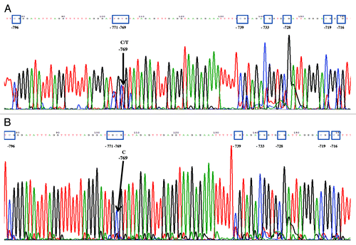 Figure 2. Representative results of the sequencing of CpG dinucleotides at the positions -796, -771, -769, -739, -733, -728, -719, -716 in the 5' untranslated promoter region of the CALCA gene in preterm neonates with bacterial sepsis and birth weight and age matched controls respectively. (A) Partial methylation of CpG at position -769 in gram-positive EOS (day 1). (B) Total methylation of CpG at position -769 in birth weight and age matched control.