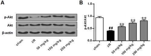Figure 5 Effects of galuteolin on Akt phosphorylation in rat cerebral infarction tissues. (A) Determination of the expressions of p-Akt and Akt in rat cerebral infarction by Western Blot. (B) Histogram of p-AktAkt protein expressions. The β-actin as a standard internal reference.