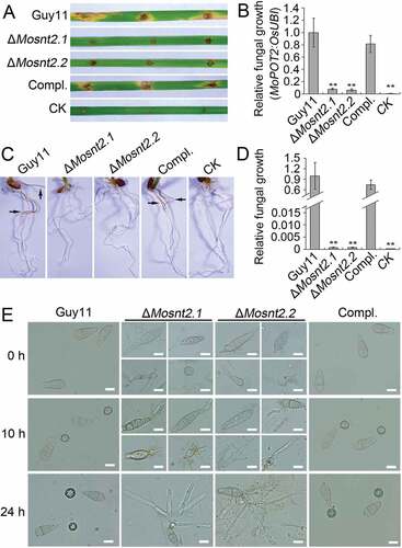 Figure 3. MoSNT2 is essential for plant infection by M. oryzae. (A) Rice leaf segments infected with fungal mycelium. (B) Measurement of fungal biomass in infected leaves based on qPCR analysis of the MoPOT2 repetitive element. CK, rice leaf segments inoculated with agar plugs without fungal mycelium. (C) Rice root infection assay. Arrows indicate typical necrotic lesions. (D) qPCR analysis of fungal biomass in inoculated rice roots. (E) Appressorium development on hydrophobic coverslip. Scale bar: 10 μm