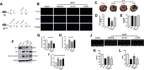 Figure 3 CircRNA Fbxl5 promotes the deterioration of cardiac function after myocardial ischemia reperfusion (MI/R). (A) The timeline of the in vivo experiment. (B) TUNEL-based evaluation of apoptosis in the ventricular myocardium; TUNEL positive cardiomyocytes were presented in green while nuclei were presented in blue by DAPI. (C–E) Representative Evans blue/TTC staining of the cross section of the ventricles (C) and quantitative analysis of the infarct size (Inf) between groups (D–E), showing that knockdown of circRNA Fbxl5 significantly reduced the infarct size after MI/R; ****P<0.0001 compared with vehicle, n=6 per group. (F–I) Representative Western blots (F) and quantitative analysis of Bcl-2, Bax and cleaved caspase 3 proteins between groups (G–I), showing that knockdown of circRNA Fbxl5 significantly attenuated cardiomyocyte apoptosis after MI/R; ***P<0.001 and ****P<0.0001 compared with sham; ##P<0.01, ###P<0.001 and ####P<0.0001 compared with vehicle; NS denotes non-significance compared with vehicle, n=3 per group. (J–L) Representative echocardiography (J) and quantitative analysis of left ventricular ejection fraction (LVEF) and fractional shortening (FS) between groups (K–L), showing that knockdown of circRNA Fbxl5 significantly improved cardiac function after MI/R; *P<0.05 compared with vehicle; NS denotes not significance compared with vehicle, n=3 per group.