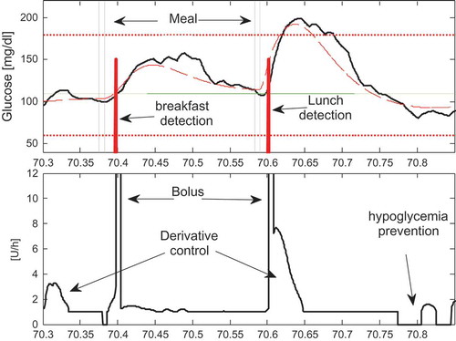FIGURE 3 (a) The evolution of the BG signal (dotted line), of the s.c measured signal (solid line), the meal “disturbances” and the meal detection signal for Scenario S1 during day 70. (b) The evolution of the overall control signal .