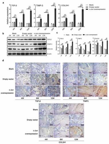 Figure 3. Expressions of TGF-β, TIMP-3, and COL2A1 in disc degeneration tissue were increased after overexpressing c-Jun. (a) The mRNA expressions of TGF-β, TIMP-3, and COL2A1 were detected using qRT-PCR assays. (b) The protein expressions of TGF-β, TIMP-3, and COL2A1 were determined using western blot assays. (c) Relative density of TGF-β, TIMP-3, and COL2A1 in (B) was analyzed by Image J. (d) The protein expressions of TGF-β, TIMP-3, and COL2A1 were assumed by immunohistochemistry. Scale bar, 50 μm, magnification, 400 × . One-way ANOVA followed by post hoc Tukey’s test was used for data analysis (mean ± SD, n = 5). ‘*’ p < 0.05 ‘**’ p < 0.01