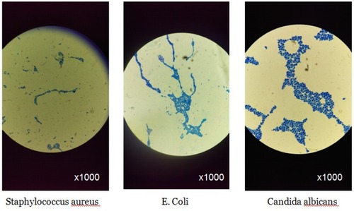 Figure 2 The optical microscopy images of the studied microorganisms.