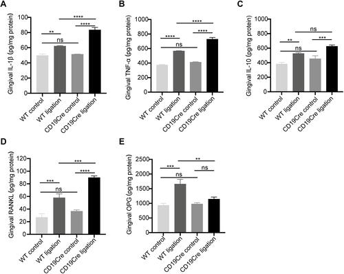 Figure 3 Gingival protein expression of inflammatory cytokines IL-1β (A), TNF-α (B), and IL-10 (C), and RANKL (D) and OPG (E). Data are represented as pg/mg total protein and shown as the mean ± standard error of the mean (n = 6 per group). **P < 0.01, ***P < 0.001, ****P < 0.0001, ns no significance (one-way ANOVA).