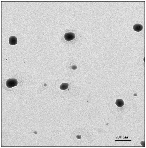 Figure 2. TEM image of ART-NLC.