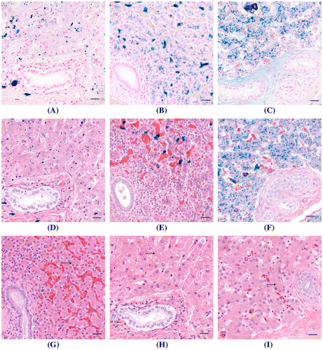 Figure 1. A comparison of the modified PB/H&E combination stain to H&E and PB/NFR stains on liver samples containing iron from three species. (A) Liver, mammal; (B) liver, bird; (C) liver, reptile. Iron is the granular blue material in cytoplasm of hepatocytes and sinusoidal macrophages. Cytoplasm of hepatocytes is pale pink with a light blue background. Collagen is pale pink. Nuclei are stained red. PB/NFR. Bar = 20 μm. (D) Liver, mammal; (E) liver, bird; (F) liver, reptile. Iron is the granular blue material in cytoplasm of hepatocytes. Cytoplasm of hepatocytes and collagen stain various shades of pink, and nuclei are stained deep blue, comparable to the H&E-stained section. Modified PB/H&E. Bar = 20 μm. (G) Liver, mammal; (H) liver, bird; (I) liver, reptile. Iron i.e. hemosiderin (arrows) is the granular brown material in cytoplasm of hepatocytes and sinusoidal macrophages. Cytoplasm of hepatocytes and collagen stain various shades of pink. Nuclei are deep blue. H&E. Bar = 20 μm.