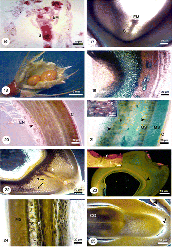 Figures 16-25. Different developmental stages of seed and embryo in Onobrychis persica under bright field and fluorescence microscopes with different magnifications. 16: Early heart-shaped embryo (EM) with suspensor (S) consisting of one column of cells. 17: The heart-shaped embryo (EM) and suspensor (S). 18: Onobrychis mature legume contained just one seed but the legumes with two seeds were also observed. 19: Longitudinal section of seed stained with methylene blue shows the distinguishable layers in seed. 20: Transverse section of seed stained with Sudan black B and polarizing microscopy shows lipid reserves in cuticle layer (C) and endosperm (EN) specially in aleurone layer (black arrowhead). 21: Staining of seed coat and endosperm with toluidine blue indicates starch grains (black arrowheads); positive reaction for phenolic compounds gives a green color. Starch grains are absent in macrosclereids (MS) but there are high accumulation of starch grains in osteosclereids (OS) and parenchyma cells (P). Cuticle layer (C) is thick. 22: Staining with lugol indicates starch grains (black arrows). Storage of starch grains during embryogenesis is visible in the seeds. The tracheid bar is distinguishable (white arrowhead). 23: At the hilar pole, double palisade layer (white arrowheads), subhilar parenchyma, and tracheid bar is distinguishable. The aleurone layer is also noticeable (black arrowhead) in the larger figure. 24: A part of testa showing macrosclereids (MS), osteosclereids (OS) and parenchyma cells (P), and accumulation of starch grains. 25: Cotyledon (CO) stage which accumulate starch. In this stage suspensor shows signs of degeneration (black arrow). Note: In Figures 19–25 seed sections were stained with different staining techniques and different microscopes were used (bright field, polarizing and fluorescence).