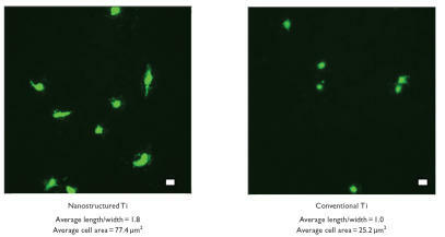 Figure 8 Increased rat aortic endothelial cell (RAEC) spreading on nanostructured cp Ti. Scale bar = 10 μm.