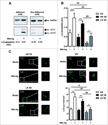 Figure 1. Levels of autophagy induced in response to Mtb-Ag in tuberculosis patients and healthy donors. (A and B) PBMC from HD, HR TB and LR TB were cultured at 3 × 106 cells/ml in RPMI with 10% FBS. Cells were then cultivated for 16 h without stimulus to allow the adherence of monocytes. Afterwards, PBMC were stimulated with sonicated M. tuberculosis (Mtb-Ag) for 24 h, protein extracts were obtained and western blot was performed. Densitometry of the blots was performed and the means of the ratios of LC3-II to GAPDH were expressed as arbitrary units (AU). (A) A representative example of a HR TB patient is shown. (B) Bars represent the mean values ± SEM. *P < 0.05, **P < 0.01, ***P < 0.001, Wilcoxon matched-pairs signed rank test; #P < 0.05, ##P < 0.01 Mann-Whitney Test. (C) PBMC from HD and HR TB and LR TB patients were incubated at 2 × 106 cells/ml in RPMI with 10% FBS. PBMC were then stimulated with or without Mtb-Ag for 24 h and immunofluorescence for LC3 was performed. Samples were then analyzed in a confocal microscope. Representative images of a HD, a HR TB, and a LR TB patient are shown. Bars represent the mean values of the number of LC3 puncta/cell ± SEM. *P < 0.05, **P < 0.01, Wilcoxon matched-pairs signed rank test; ##P < 0.01 Mann-Whitney Test.