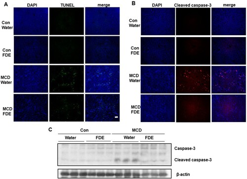 Figure 3. FDE attenuated liver injury and hepatocyte apoptosis in mice induced by MCD. (a) Apoptotic cells of the liver were detected using a TUNEL assay (scale bars, 100μm). (b) Representative immunofluorescent staining of cleaved-caspase3 (scale bars, 100μm). (c) The protein expressions of cleaved caspase-3 and caspase-3 were determined by Western blot analysis.